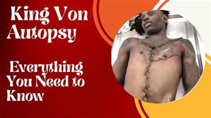 Autopsy of King Von: Uncovering the Truth Behind the Legend
