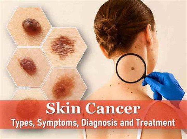 Does Khalyla Kuhn Have Cancer? An In-Depth Look at Her Health and Life