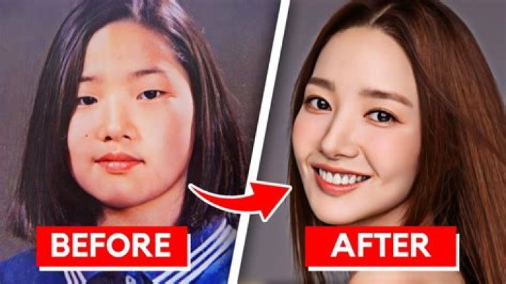 Kim Young-dae Plastic Surgery: The Truth Behind the Transformation