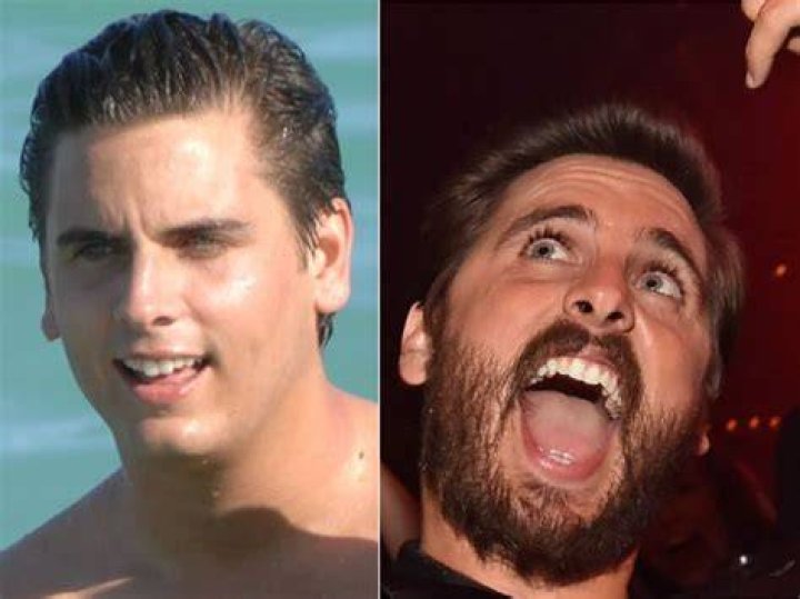 Scott Disick and Ozempic: Exploring the Weight Loss Journey