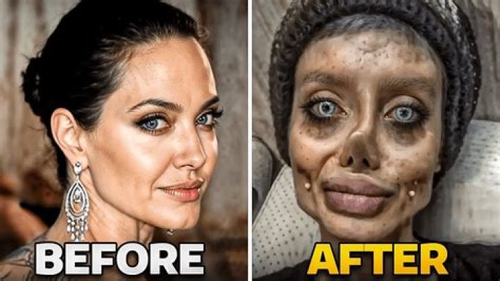 Skyelar Chase and Her Journey Through Plastic Surgery: A Comprehensive Analysis