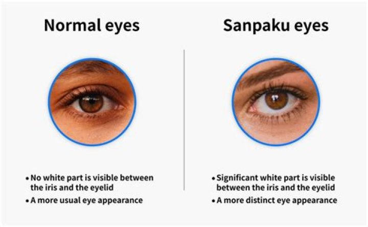 Understanding Sanpaku Eyes: The Intriguing Phenomenon and Its Cultural Significance
